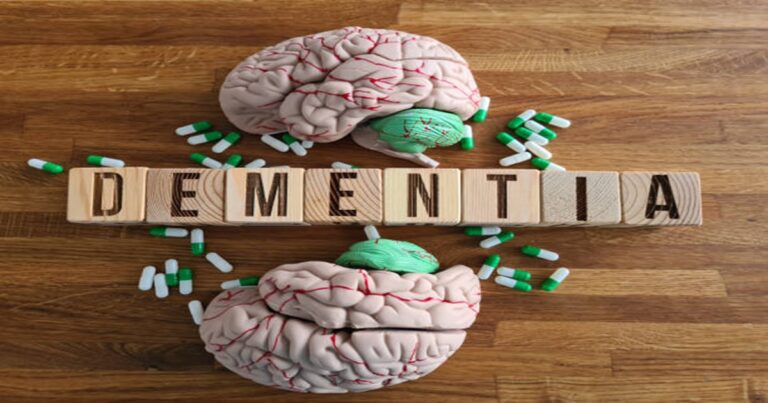 13 Easy Ways to Lower Dementia Risk and Stay Sharp